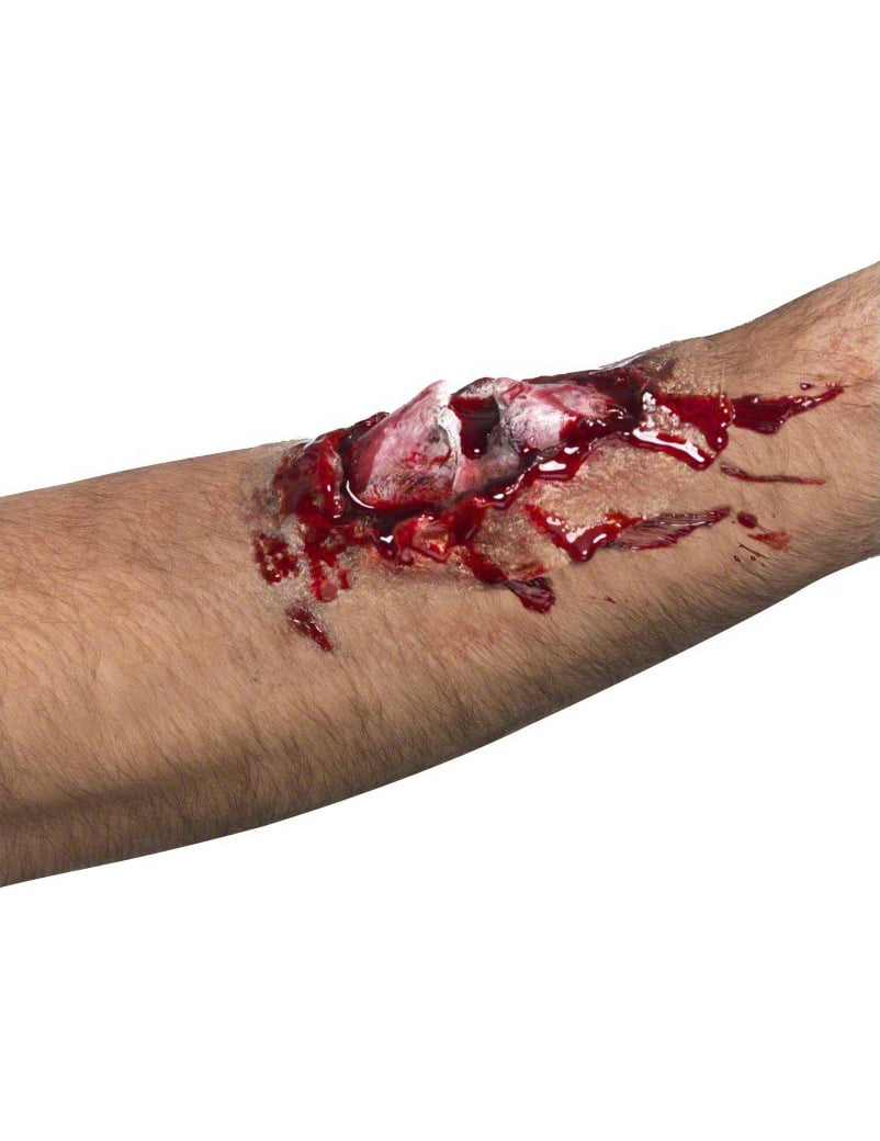 Lažna ozljeda slomljene kosti za odrasle s krvlju